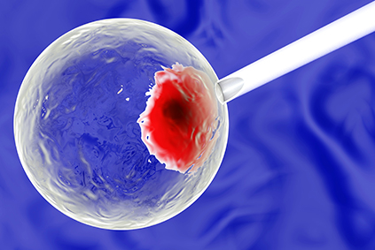 AmnioticFluidAllograft_LP
