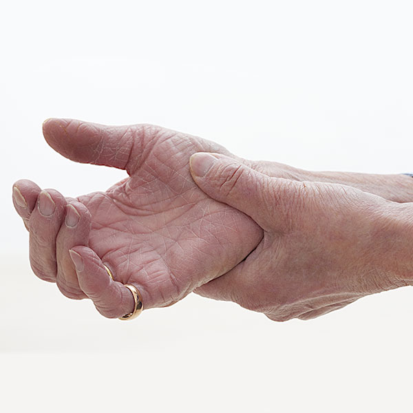Arthritis
