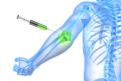 BursaInjections_LP