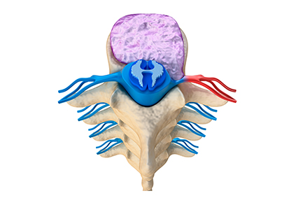 DiscTear_LP