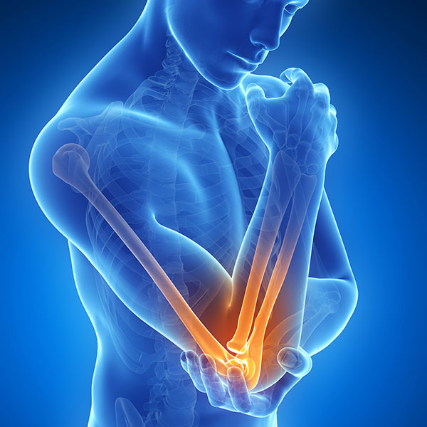 TennisElbow
